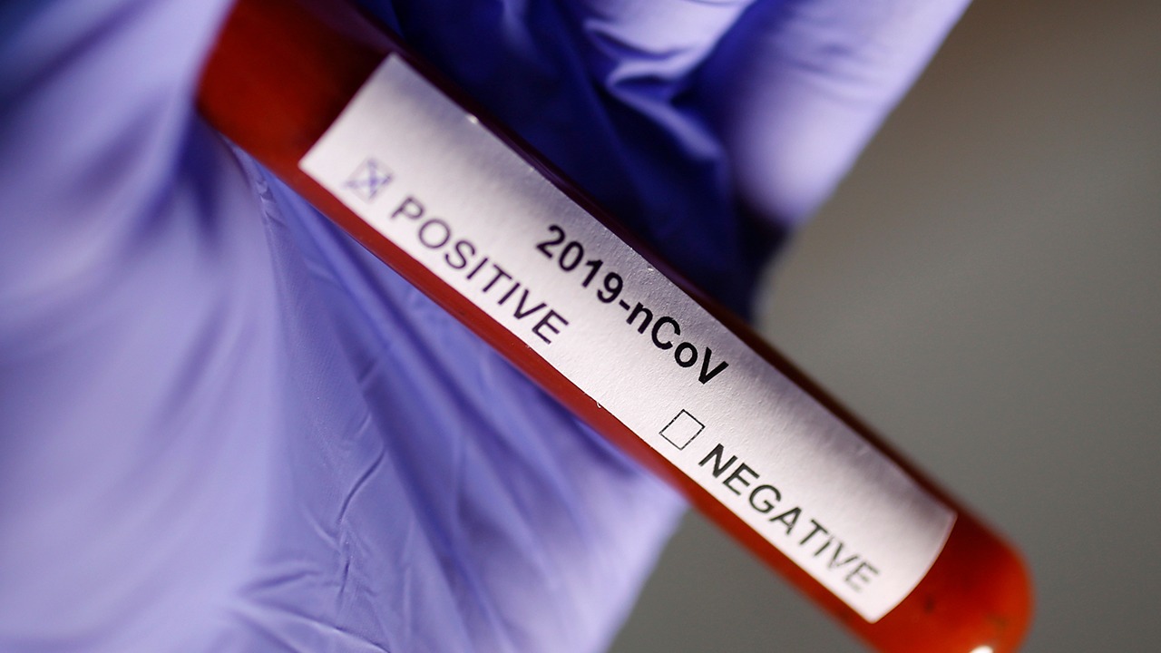 Koronavirüs 50 ülkede 82 binden fazla kişiye bulaştı
