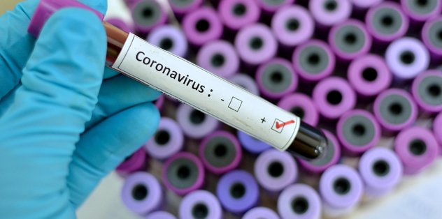 Türkiye’de Koronavirüs Vakası 5’e Çıktı!