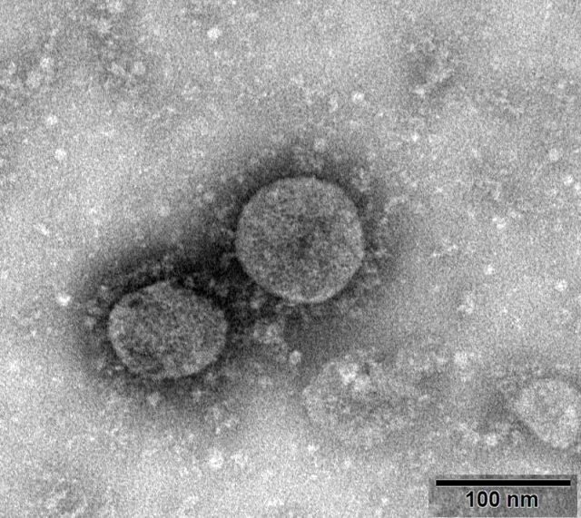 ABD'de koronavirüsün ardından yeni bir ölümcül salgın hızla yayılıyor