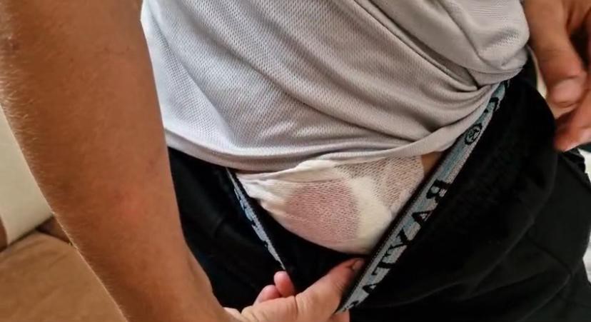 ÇINAR'DA KÖPEK DEHŞETİ EKMEK ALMAYA GİDEN ÇOCUĞA BAŞIBOŞ KÖPEKLER SALDIRDI, BALDIRI PARÇALANDI